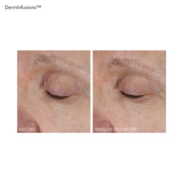 Derminfusion Lift+Repair Eye Mask 1 app